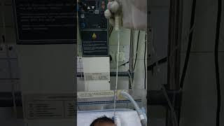 NICU baby  feeding milk  by feeding tube #motivation #video #virals #nursing work #gnm