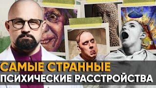 ОДЕРЖИМЫЕ?! Психиатр о ТОП-7 СТРАННЫХ И СТРАШНЫХ РАССТРОЙСТВАХ ПСИХИКИ!