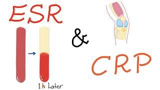 ESR and CRP