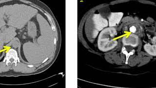 Introduction to Radiology: Computed Tomography