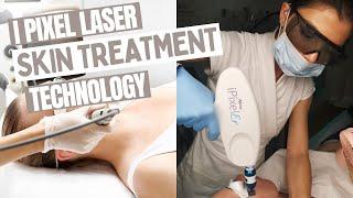 I Pixel Laser Treatment at Ray Cochrane Beauty School