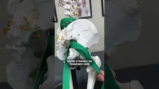 Sciatica's SECRET ROOT PROBLEM!