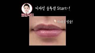쁘띠 닥터의 손길디자인 입술 필러