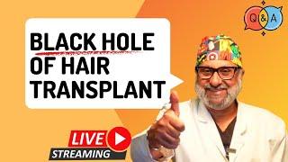 Black Hole of Hair transplant? Crown hair transplant Q&A Session #live #crownhairtransplant