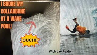 Keepin' It Reale- #19:  I broke my collarbone at a wave pool!