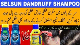 Selsun shampoo for dandruff | selsun blue shampoo | best shampoo for dandruff | tinea versicolor