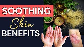 INCREDIBLE Moringa Oil Skin Benefits For RASHES Like Eczema & Psoriasis