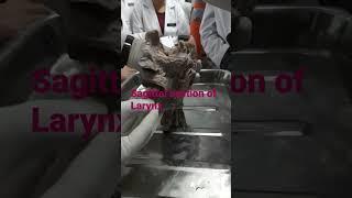 sagittal section of Larynx 3D#viral #ytshorts #populer #shorts