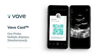 How to Teach POCUS through Vave Cast: One Probe. Multiple Displays. Simultaneously.