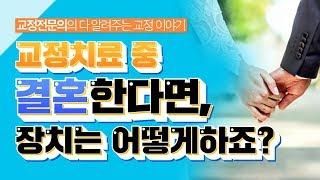 교정치료중  웨딩촬영을 해야한다면?  결혼 계획이 있다면?