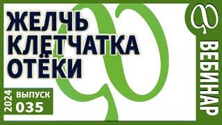 Желчь. Клетчатка. Отёки. Сеточки на ногах.  Измерение ваших показателей. Их значение