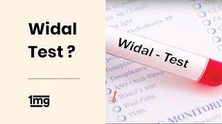 How is Widal Test done for Typhoid Fever? | 1mg