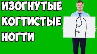 ИЗОГНУТЫЕ КОГТИСТЫЕ ногти / хиромантия / Кладезь Хиромантии