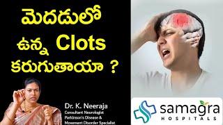 Do The Clots in The Brain Dissolve? #BrainClots #DrKNeeraja #Neurologist #Guntur #SamagraHospitals