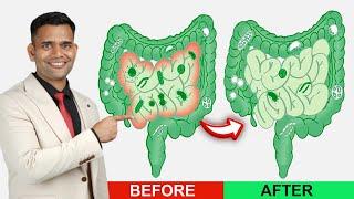 Healthy Intestine | Treat SIBO | Intestine Detox | Small intestinal bacterial overgrowth (SIBO)