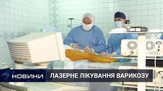 Варикозне розширення вен лікують лазером у Хмельницькій міській лікарні. 12.07.2021