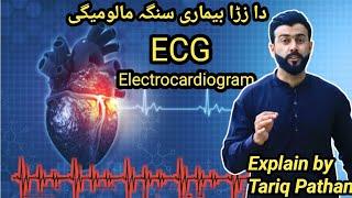 ECG explained by Tariq Pathan