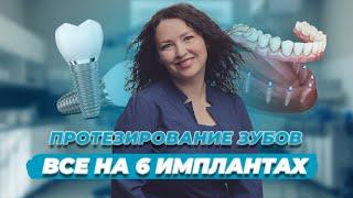 Нет зубов? Все зубы разрушены? Все об имплантации "ВСЕ НА 6". Стоматология Вариант в Самаре