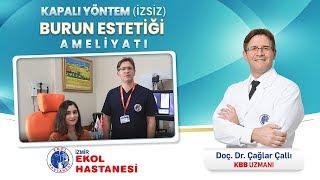 İzmir Ekol Hastanesi - Kapalı Burun Estetiği Ameliyatı - Doç. Dr. Çağlar Çallı