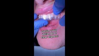 Getting your initial set of clear aligners / hybrid orthodontic / Tooth Time Family Dentistry NBTX