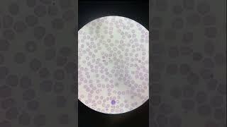 රතු රුධිර සෛල ×100 Red blood cells × 100  #healthylifestyle #microscope #health #redbloodcells