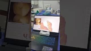 Intraoral Scanner | Zirconia Crowns | Dental Experts | Dr Brijesh Byrappa |