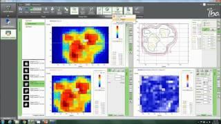 myQA Patients Software Demo Webinar