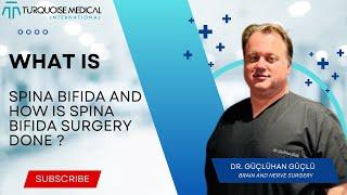 What is spina bifida and how is spina bifida surgery done ? - Brain And Nerve Surgery