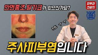 주사피부염 (Rosacea)의 유형과 치료, 일상생활 속 관리법과 화장품 선택까지 - 피부과전문의 닥터피부광