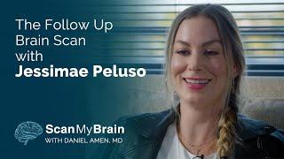 The Follow Up Brain SPECT Scan with Jessimae Peluso