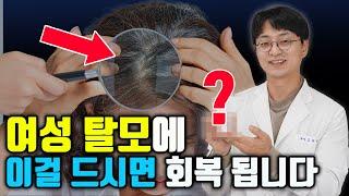 여성 탈모 약 대신 이걸 드시면 머리 숱이 풍성해집니다. 여성탈모, 갱년기성 탈모의 핵심 영양제