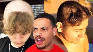 ROASTING our Subscribers Haircuts