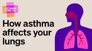 How asthma affects your lungs | Asthma + Lung UK