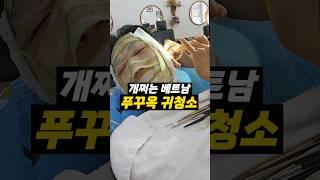 베트남 귀청소 스페샬 서비스