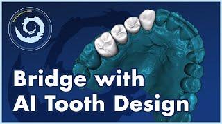 BSP V4.13: Design a Bridge With Automatic Tooth Design. Design and Export Free.