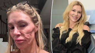 Brandi Glanville Responds to Dr. Terry Dubrow's 'Ticking Time Bomb' Comment About Her Health