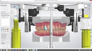 3Shape Ortho Analyzer - How to Use the Virtual Articulator in Ortho Analyzer