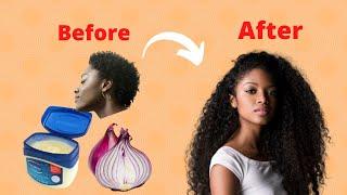 How to use Vaseline and onion to grow hair 2 cm per day Very fast