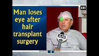 Man loses eye after hair transplant surgery - Telangana News