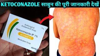 Ketoconazole Soap Uses Or Side Effects in Hindi