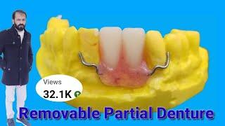 Temporary Removable Partial Denture ||Dental Art by Haider || Immediate RPD by Haider..