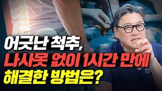어긋난 척추, 나사못 없이 1시간 만에 해결한 방법은? | 참포도나무병원 이동엽 원장