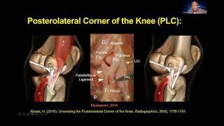 Dr. Jeimylo de Castro talks about the Complete Ligament of the Knee