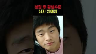 "현재는 모두 탑배우" 성형 후 얼굴이 환생수준인 남자 연예인들