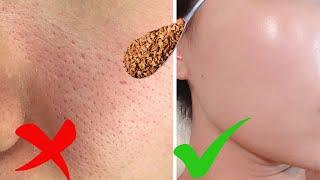 No more OPEN LARGE PORES, CLOGGED PORES | How To Shrink Pores