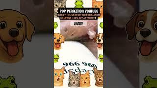 Wow! #pimpleremoval #pimple #pimples #youtube #youtubeshorts #shorts #shortvideo #short #shortsfeed