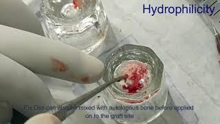 Dental Bone Graft Substitute for Dental Guided Bone Regeneration and GTR  FIX OSS