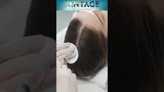 "Turkish Hairlines": The Capital of Hair Transplants? | Vantage with Palki Sharma