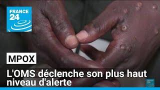 Mpox : l'OMS déclenche son plus haut niveau d'alerte mondiale • FRANCE 24