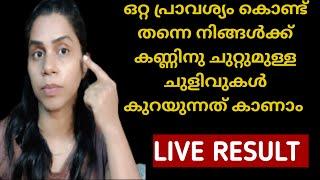 കണ്ണിനു ചുറ്റുമുള്ള ചുളിവുകൾ കറുപ്പ് തടിപ്പ് ഇതെല്ലാം പെട്ടന്ന് മാറ്റാൻ EYE MASSAGE| LIVE RESULT